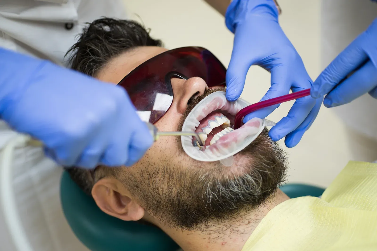 Comprehensive Guide to Cracked Tooth Repair in Denham Springs, LA