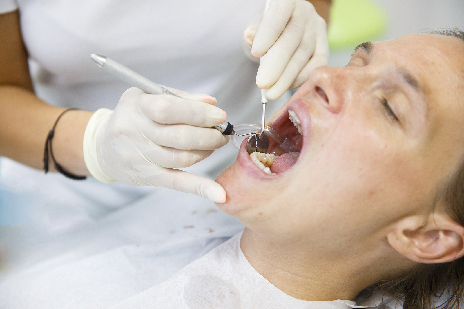 Preventing Tooth Abscesses: Essential Tips for Maintaining Dental Health