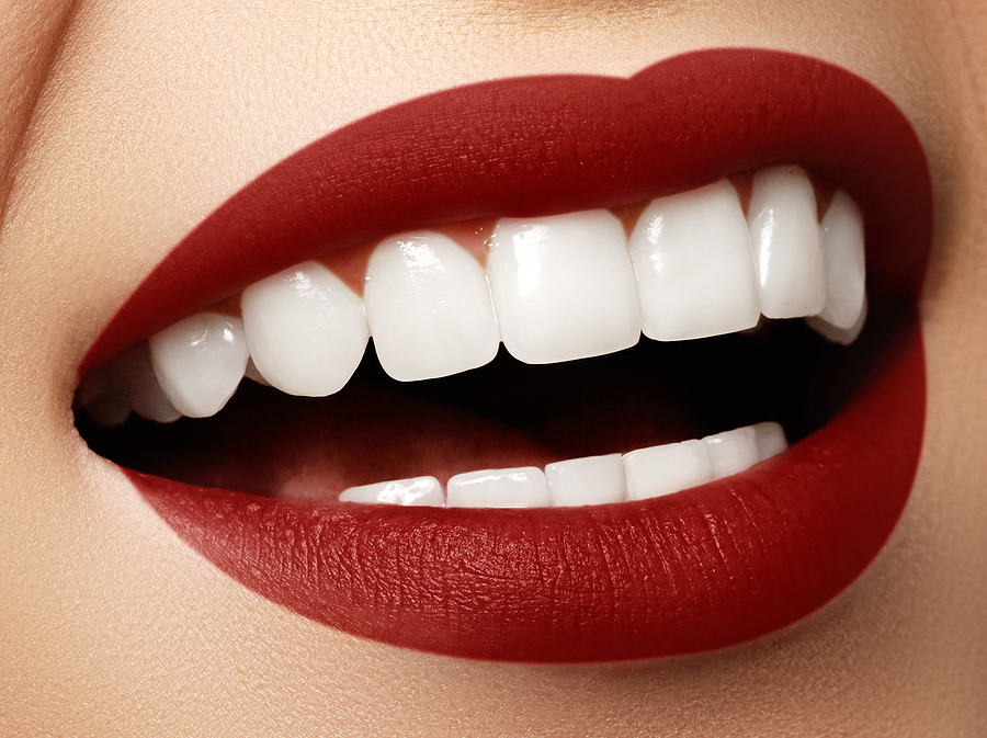 Experience a Bright Smile with Whitening For Life in Denham Springs, LA